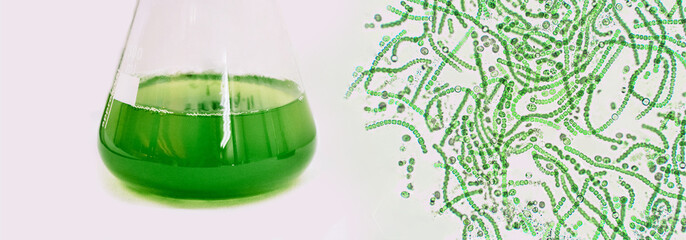 Algal research, energy and healthcare treatment biotechnology, photobioreactor in medical science...