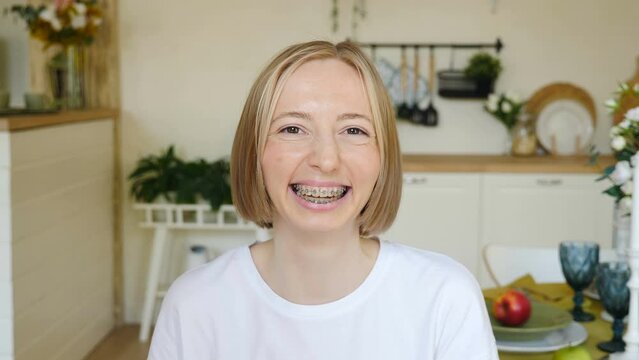 Portrait of young smiling confident woman or teenage girl in braces on teeth wearing white t-shirt looking at camera. Orthodontic Treatment. self-ligating brackets. Dental clinic and health concept. 4