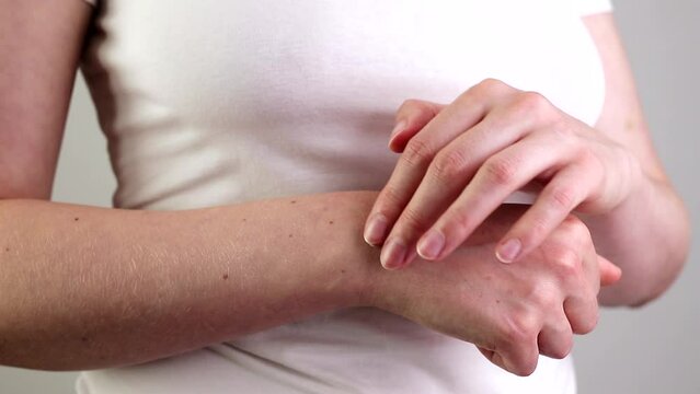Applying pain relief cream, medical ointment on hand wrist trauma