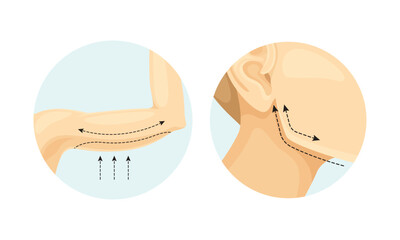 Plastic Surgery for Arms and Face as Restoration and Reconstruction of Human Body in Circle Vector Set