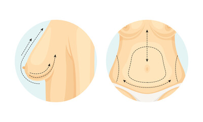 Plastic Surgery for Breast and Belly with Stipple Line in Circle Vector Set
