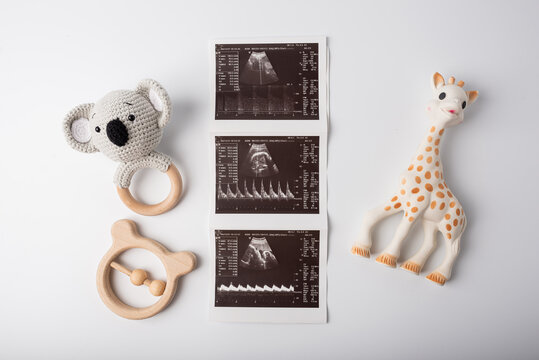 ultrasound shot with children's toys. Concept of expecting a baby