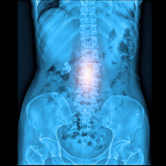 x-ray film medical