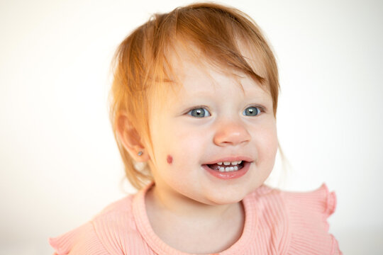 Portrait of a charming funny red-haired baby girl with blue eyes and a birthmark on her cheek. Hemangioma. Light background. Lifestyle