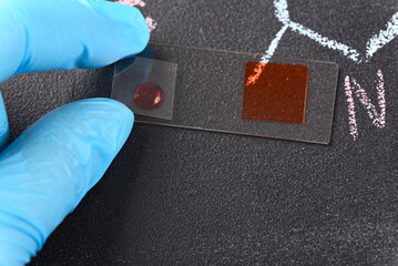 Two drops of red liquid on the  microscope slide and chemical formula on the background.