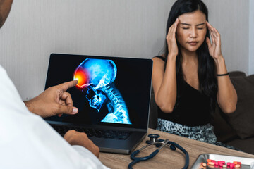 Doctor showing a x-ray of pain in the brain on a laptop. Migraine Headache