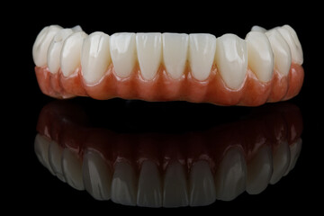 dental prosthesis of the lower jaw with gums and relief of teeth on black glass with reflection