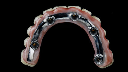 titanium bar in the prosthesis of the upper jaw, top view on a black background