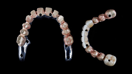 two titanium dental bars with crowns, top view on a black background