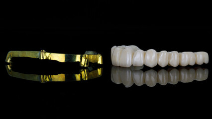 dental prosthesis of the upper jaw from zircon with a beam of gold-colored titanium on black glass with reflection © Dental Pro Content