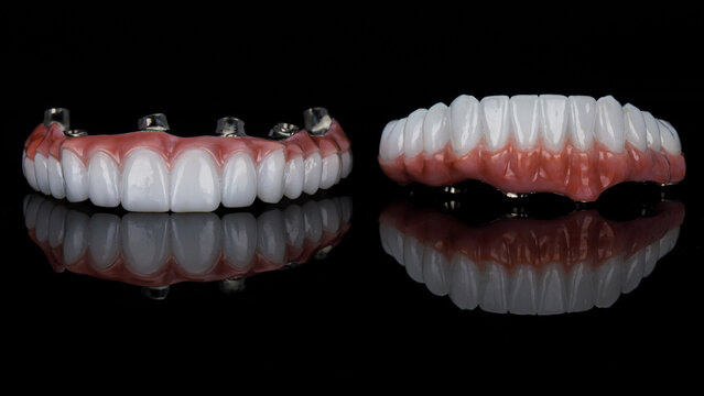 two excellent dental prostheses made of zircon and titanium on a black background with reflection