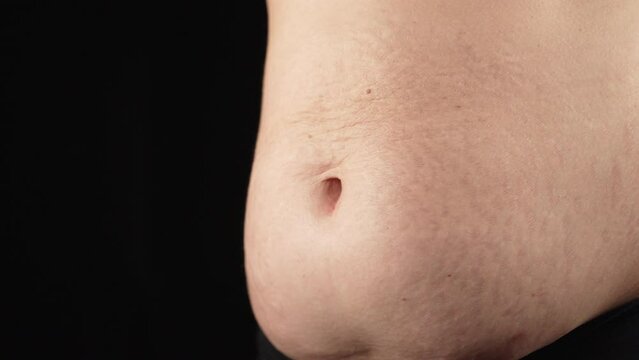 Woman belly during breathing exercises bodyflex. Showing stretch marks on abdomen after pregnancy. Natural body texture. Mother with heavy wrinkles,loose skin after birth child