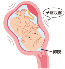 切迫早産　子宮の中の赤ちゃん　妊娠中の母体の仕組み - obrazy, fototapety, plakaty
