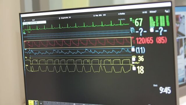 Digital Screen Show Vital Sign, Heart Rate and Blood Pressure, No People, Close Up