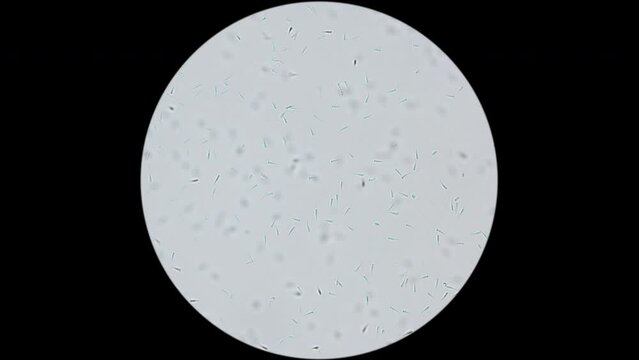 Cerebratulus worm sperm under microscope, Nemertea Phylum, Family Lineidae. White Sea