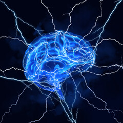 Illustration of human brain with lightning strikes on dark background