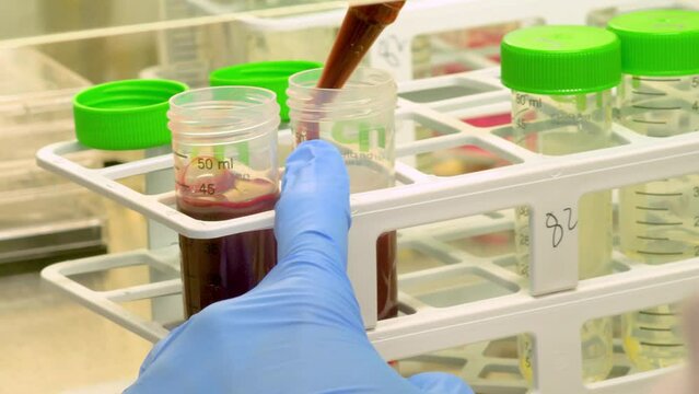 4k real time - hospital staff carrying out medical research in the laboratory with pipettes, test tubes, samples, etc...