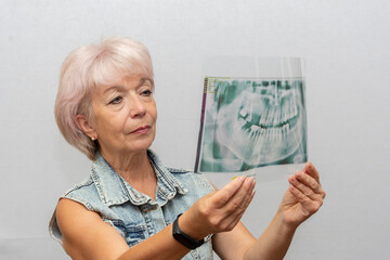 An elderly woman aged 60-65 looks at an X-ray of her teeth on a white background. Concept: treatment and prosthetics of the oral cavity, false teeth and implants.