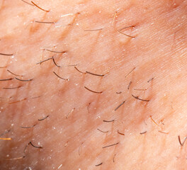 Hair on the skin of a man's face. Macro