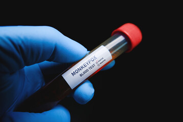 Monkeypox (MPXV) blood sample in test tube holding by doctor hand,Monkeypox outbreak pandemic prevention concept