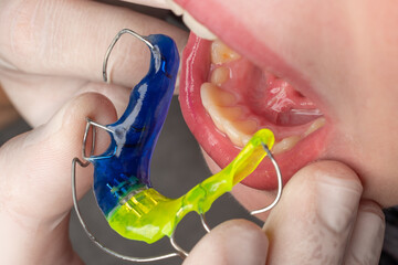 Plate for the lower teeth, orthodontic and plate for the teeth of the lower jaw. © Niko_Dali