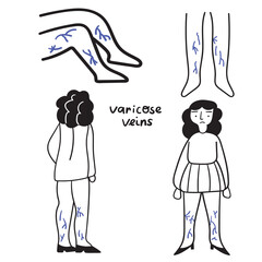 Collection of outline icons. Varicose veins. Vector outline illustrations on white background.