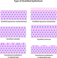 Type of Stratified Epithelium