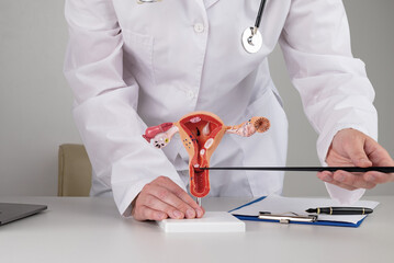 doctor gynecologist pointing model of female reproductive system on his desktop - obrazy, fototapety, plakaty