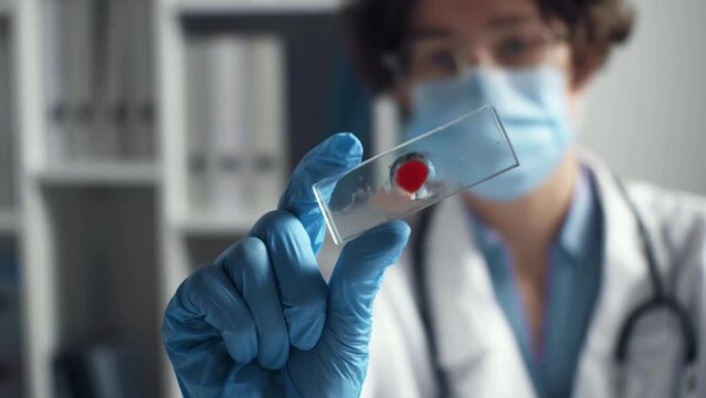 Doctor hand looks at drop of blood on glass slide on microscope slide. Woman doctor with blood sample on glass slide. Drop of blood for research, research in medical laboratory. Laboratory blood test