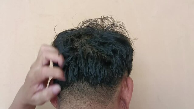 Man scratching his head because of dandruff.