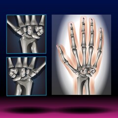 Wrist Anatomy - Fla source file available  - Carpal bones. Human hand anatomy. small bones of the wrist: Scaphoid, Lunate, Triquetrum, Pisiform, Trapezium, Trapezoid, Capitate and Hamate. Vector