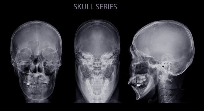 skull skull series