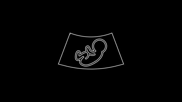 White line Ultrasound of baby icon isolated on black background. Fetus. 4K Video motion graphic animation