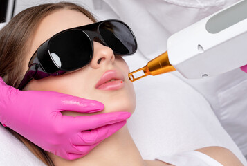 Removal of permanent makeup on the lips of a woman.Carbon face peeling in a beauty salon. Hardware...