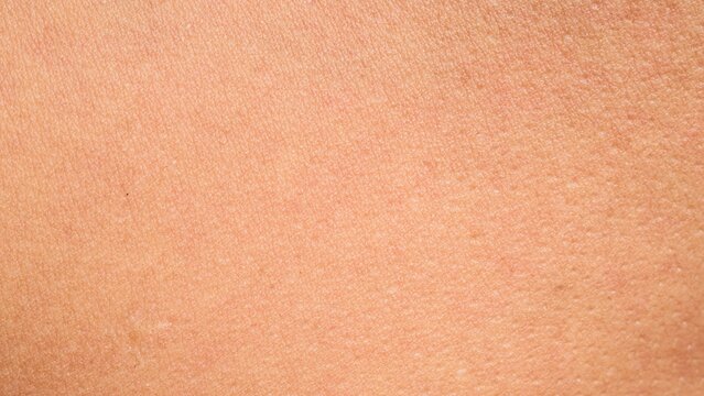 Skin texture hotsell