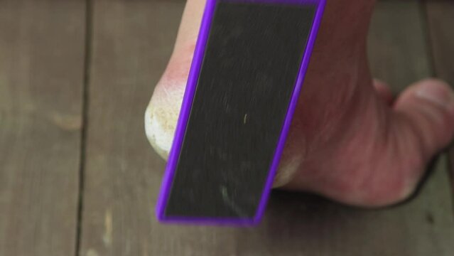 A metal grater cleans a cracked heel. Keratinization and thickening of the epidermis in the plantar surface of the feet. Foot care concept. Isolated video, copy space, close-up. UHD 4K.