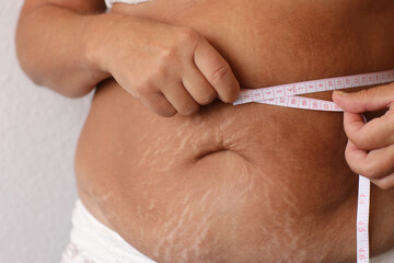 Cropped photo of naked overweight woman belly in underwear, trying to lose weight. Holding and measuring her waistline by roulette tape belly, abdomen. Fat large sagging folds on stomach. Excess skin