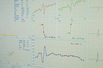 Bicycle Ergometry Electrocardiography, bicycle ergometer stress test. Athlete does a cardiac stress test in a medical study, monitored by the doctor