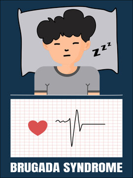 Brugada (brew-GAH-dah) syndrome ; this can be lead to fainting or death during sleep or rest 