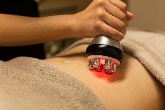 therapist giving gel cavitation massage to a woman 