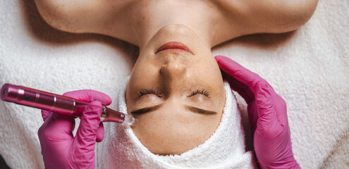 The cosmetologist's hands making the procedure Microdermabrasion of the woman's face. Health care,...