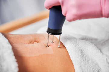 Laser device gradually moving on skin of abdomen, providing maximum area for treatment defected...