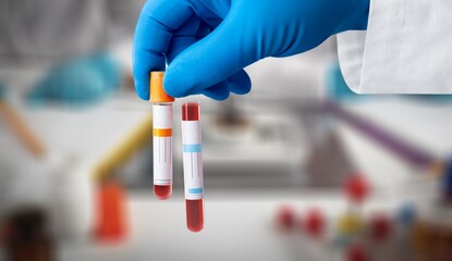 Woman holding test tube with blood, health concept