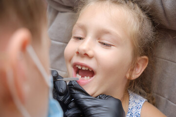 examination, treatment teeth children. Child without milk tooth smiling.medical checkup oral cavity with instruments. dental hands, child in clinic. Happy kid in dentist chair. concept health medicine