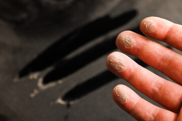 caucasian hand with dust on finger tips after touching black dusty surface, closeup with selective...