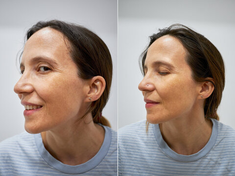 Portrait of before and after nose piercing to a woman Stock Foto Adobe Stock
