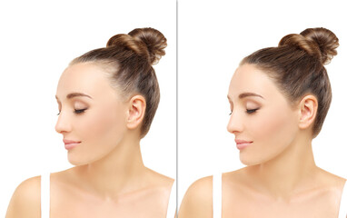 Thinning hair and hair loss,female pattern baldness,Hair transplant