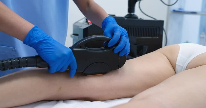 Elos epilation is procedure for removing hair on woman body