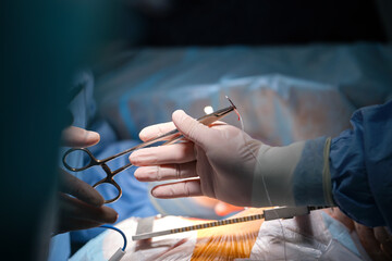 Closeup of professional doctor hands operating a patient during open heart surgery in surgical...