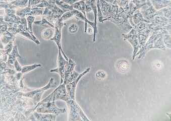 Human embryonic kidney (HEK293) cells cultured in vitro. Microscopic phase contrast image. Such...
